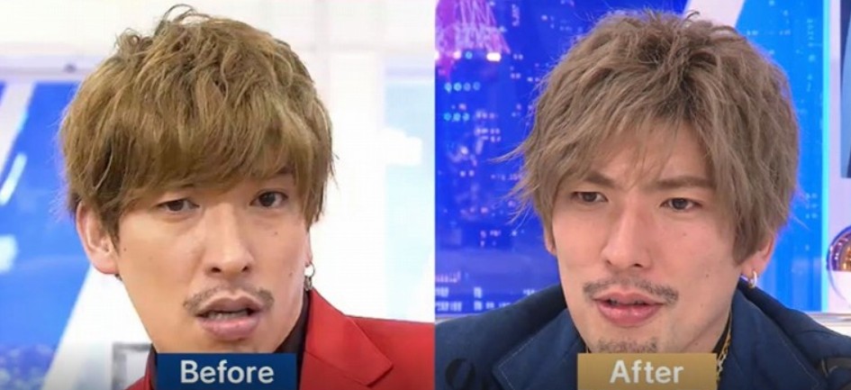 整形疑惑は本当？昔と今の変化を客観的に整理